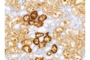 ABIN6256518 and ABIN6267413 at 1/100 staining human normal kidney tissue by IHC-P. (CEBPB Antikörper  (pThr188, pThr235))