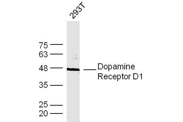 Dopamine Receptor d1 Antikörper  (AA 101-200)