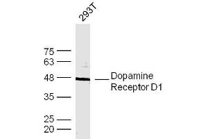 Human 293T cells probed with DRD1 Polyclonal Antibody, unconjugated  at 1:300 overnight at 4°C followed by a conjugated secondary antibody at 1:10000 for 90 minutes at 37°C. (Dopamine Receptor d1 Antikörper  (AA 101-200))