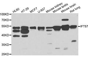 Western blot analysis of extracts of various cell lines, using IFT57 antibody. (IFT57 Antikörper)