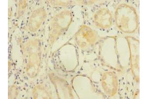 Immunohistochemistry of paraffin-embedded human kidney tissue using ABIN7162558 at dilution of 1:100 (ZDHHC6 Antikörper  (AA 227-409))