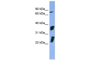 WB Suggested Anti-FGFR2 Antibody Titration: 0. (FGFR2 Antikörper  (C-Term))