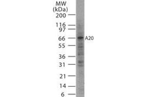 Image no. 1 for anti-Tumor Necrosis Factor, alpha-Induced Protein 3 (TNFAIP3) antibody (ABIN207992) (TNFAIP3 Antikörper)