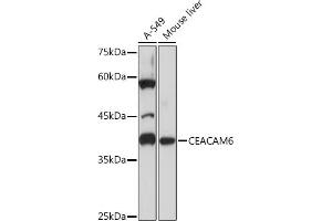 Western blot analysis of extracts of various cell lines, using CE Rabbit mAb (ABIN7266085) at 1:1000 dilution. (CEACAM6 Antikörper)