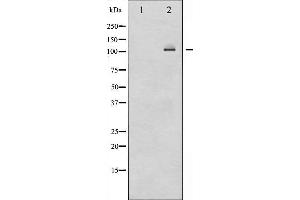 Western Blotting (WB) image for anti-Nuclear Factor of kappa Light Polypeptide Gene Enhancer in B-Cells 2 (NFKB2) (C-Term) antibody (ABIN6263614)