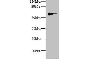Western blot All lanes: SLC22A8antibody IgG at 1. (SLC22A8 Antikörper  (AA 473-542))