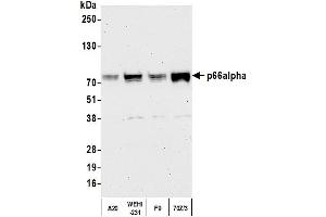 anti-GATA Zinc Finger Domain Containing 2A (GATAD2A) (AA 573-633) antibody