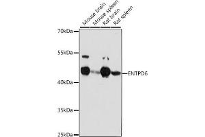 Western blot analysis of extracts of various cell lines, using ENTPD6 antibody (ABIN7266897) at 1:1000 dilution. (ENTPD6 Antikörper  (AA 61-300))