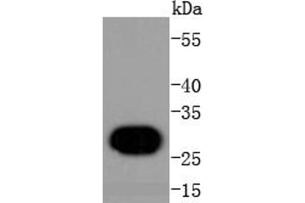 Histone H1 Antikörper