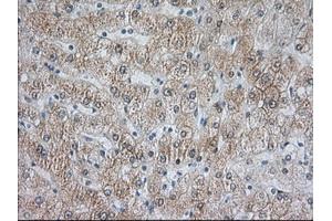 Image no. 5 for anti-Acetyl-CoA Acetyltransferase 2 (ACAT2) antibody (ABIN1496403) (ACAT2 Antikörper)