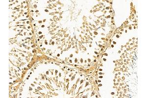 ABIN6262390 and ABIN6268885 at 1/100 staining Rat testis tissue by IHC-P.