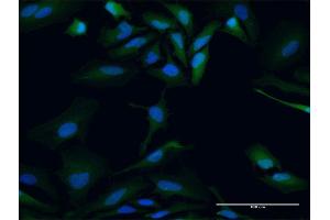 Immunofluorescence of purified MaxPab antibody to PBK on HeLa cell. (PBK Antikörper  (AA 1-322))