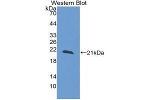 Western blot analysis of the recombinant protein. (Reelin Antikörper  (AA 26-190))