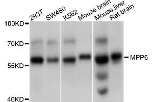 Western blot analysis of extracts of various cell lines, using MPP6 antibody (ABIN5998250) at 1/1000 dilution. (MPP6 Antikörper)