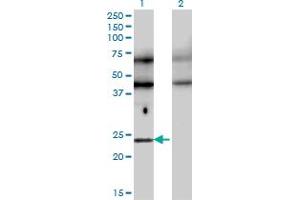 Western Blot analysis of TFEC expression in transfected 293T cell line by TFEC monoclonal antibody (M08), clone 4F11. (TFEC Antikörper  (AA 1-89))