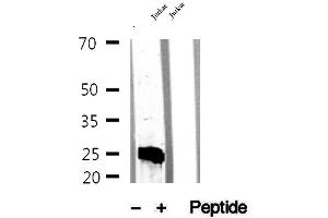 Western blot analysis of extracts of Jurkat cells, using MPZL2 antibody. (MPZL2 Antikörper  (Internal Region))