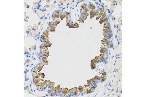 Immunohistochemistry of paraffin-embedded mouse lung using B9D1 antibody at dilution of 1:100 (x40 lens). (B9D1 Antikörper)