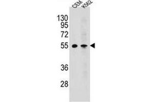 Western blot analysis of MCHR1 / GPR24 Antibody (C-term) in CEM,K562 cell line lysates (35ug/lane).