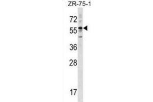 Western Blotting (WB) image for anti-Keratin 3 (KRT3) antibody (ABIN2998972) (Keratin 3 Antikörper)