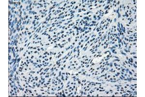 Image no. 7 for anti-Crystallin, alpha B (CRYAB) antibody (ABIN1497644) (CRYAB Antikörper)