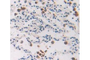 IHC-P analysis of Human Tissue, with DAB staining. (EZH1 Antikörper  (AA 559-747))