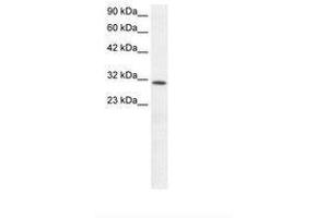 Image no. 1 for anti-Kruppel-Like Factor 8 (KLF8) (AA 89-138) antibody (ABIN6735825) (KLF8 Antikörper  (AA 89-138))