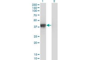 Western Blotting (WB) image for anti-DNA Fragmentation Factor, 45kDa, alpha Polypeptide (DFFA) (AA 231-331) antibody (ABIN514956)