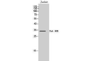 Western Blotting (WB) image for anti-RAB40B, Member RAS Oncogene Family (RAB40B) (C-Term) antibody (ABIN3186627)