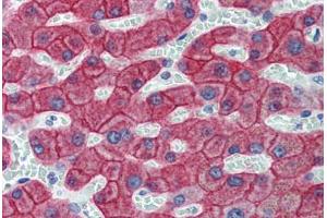 Liver, Human: Formalin-Fixed, Paraffin-Embedded (FFPE) (Cytokeratin 18 Antikörper)