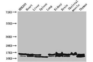 Western Blot Positive WB detected in: HEK293 whole cell lysate, Mouse heart tissue, Mouse liver tissue, Mouse spleen tissue, Mouse lung tissue, Mouse kidney tissue, Mouse brain tissue, Mouse skeletal muscle tissue, Mouse thymus tissue All lanes: NDUFB6 antibody at 3 μg/mL Secondary Goat polyclonal to rabbit IgG at 1/50000 dilution Predicted band size: 16, 14 kDa Observed band size: 16, 14 kDa (NDUFB6 Antikörper  (AA 2-67))