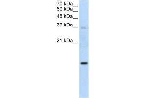WB Suggested Anti-UBE2D2 Antibody Titration:  1. (UBE2D2 Antikörper  (Middle Region))
