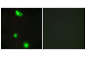 Immunofluorescence analysis of MCF-7 cells, using SFRS3 antibody. (SRSF3 Antikörper  (C-Term))