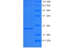 SDS-PAGE (SDS) image for Interferon epsilon (IFNE) (AA 24-195), (full length) protein (His tag) (ABIN7479449)