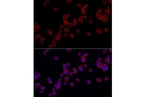 Immunofluorescence analysis of THP-1 cells using TLR4 Rabbit pAb (ABIN6134489, ABIN6149223, ABIN6149226 and ABIN6220893) at dilution of 1:100 (40x lens). (TLR4 Antikörper  (AA 500-600))