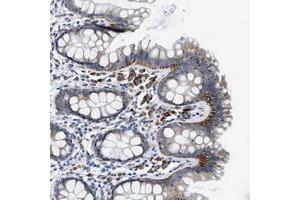 Immunohistochemical staining of human colon with ZDHHC3 polyclonal antibody  shows cytoplasmic positivity in glandular cells at 1:50-1:200 dilution. (ZDHHC3 Antikörper)