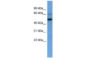WB Suggested Anti-IQCB1 Antibody Titration: 0. (IQCB1 Antikörper  (C-Term))