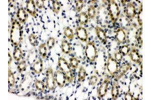 Anti- TCPTP Picoband antibody,IHC(P) IHC(P): Rat Kidney Tissue (PTPN2 Antikörper  (AA 1-330))
