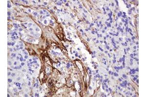 Image no. 1 for anti-GTPase NRas (NRAS) antibody (ABIN1499821) (GTPase NRas Antikörper)