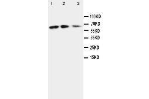Anti-CX3CL1 antibody, Western blotting Lane 1: Recombinant Mouse Fractalkin Protein 10ng Lane 2: Recombinant Mouse Fractalkin Protein 5ng Lane 3: Recombinant Mouse Fractalkin Protein 2. (CX3CL1 Antikörper  (N-Term))