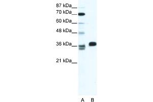 WB Suggested Anti-ESX1 Antibody Titration:  1. (ESX Homeobox 1 Antikörper  (N-Term))