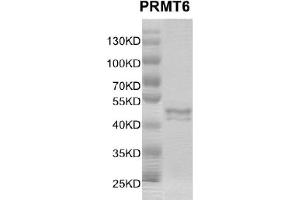 Recombinant PRMT6 protein gel.