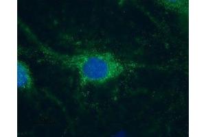 Immunocytochemistry (ICC) image for anti-Hyperpolarization Activated Cyclic Nucleotide-Gated Potassium Channel 1 (HCN1) (AA 6-24), (Intracellular) antibody (ABIN7043278)