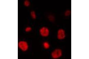ABIN6274328 staining HepG2 cells by IF/ICC. (ELAVL2 Antikörper  (N-Term))
