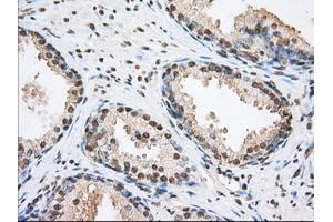 Image no. 11 for anti-Transforming, Acidic Coiled-Coil Containing Protein 3 (TACC3) antibody (ABIN1498099) (TACC3 Antikörper)