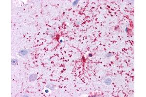 Immunohistochemistry (IHC) image for anti-Glutamate Dehydrogenase 1 (GLUD1) (N-Term) antibody (ABIN2782329)