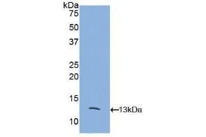 Detection of Recombinant MCP2, Mouse using Polyclonal Antibody to Monocyte Chemotactic Protein 2 (MCP2) (CCL8 Antikörper  (AA 20-94))