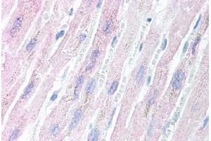 Human Heart (formalin-fixed, paraffin-embedded) stained with AES antibody ABIN213897 at 5 ug/ml followed by biotinylated goat anti-rabbit IgG secondary antibody ABIN481713, alkaline phosphatase-streptavidin and chromogen. (AES Antikörper  (N-Term))