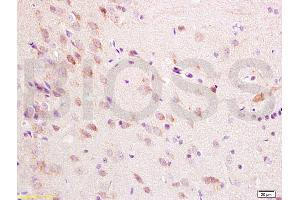 Formalin-fixed and paraffin embedded rat brain tissue labeled with Anti-ChRM1/Acetylcholine receptor(M1) Polyclonal Antibody, Unconjugated (ABIN738396) at 1:200 followed by conjugation to the secondary antibody, (SP-0023), and DAB staining