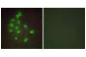Immunofluorescence analysis of A549 cells, using HAND1 antibody. (HAND1 Antikörper)