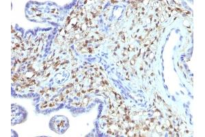 Immunohistochemistry (IHC) image for anti-S100 Calcium Binding Protein A4 (S100A4) (AA 1-200) antibody (ABIN6940541)